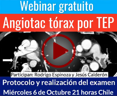 Webinar Diagnotecmed angiotac tórax por TEP